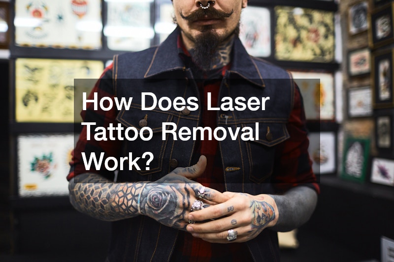 How Does Laser Tattoo Removal Work?