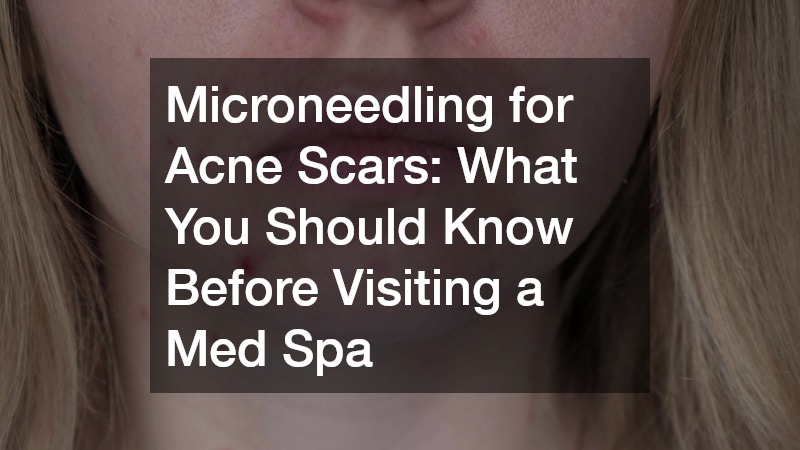 close-up of acne scars on a woman's chin